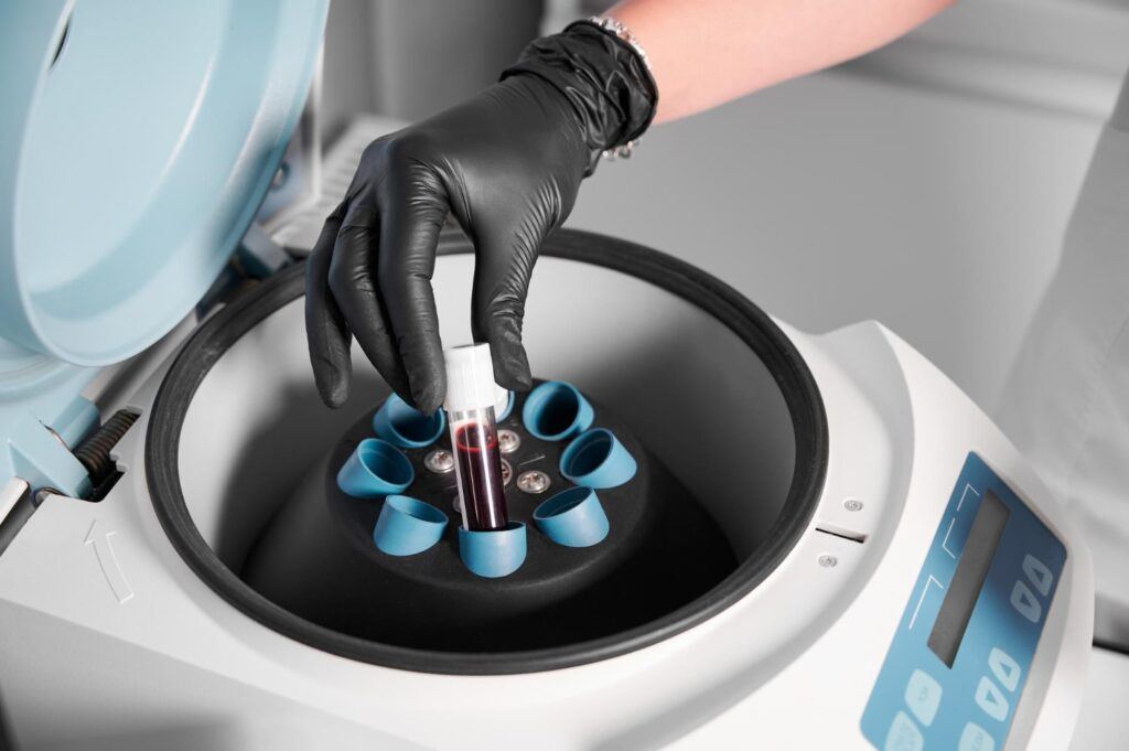 High-speed centrifuge separating blood components for PRP extraction.
