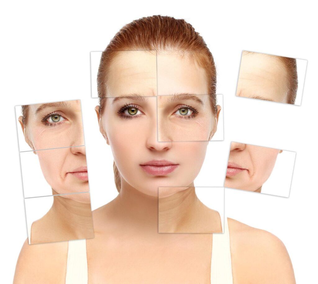 Before and after images of a skin transformation, demonstrating the effectiveness of tailored skincare treatments in addressing specific concerns.